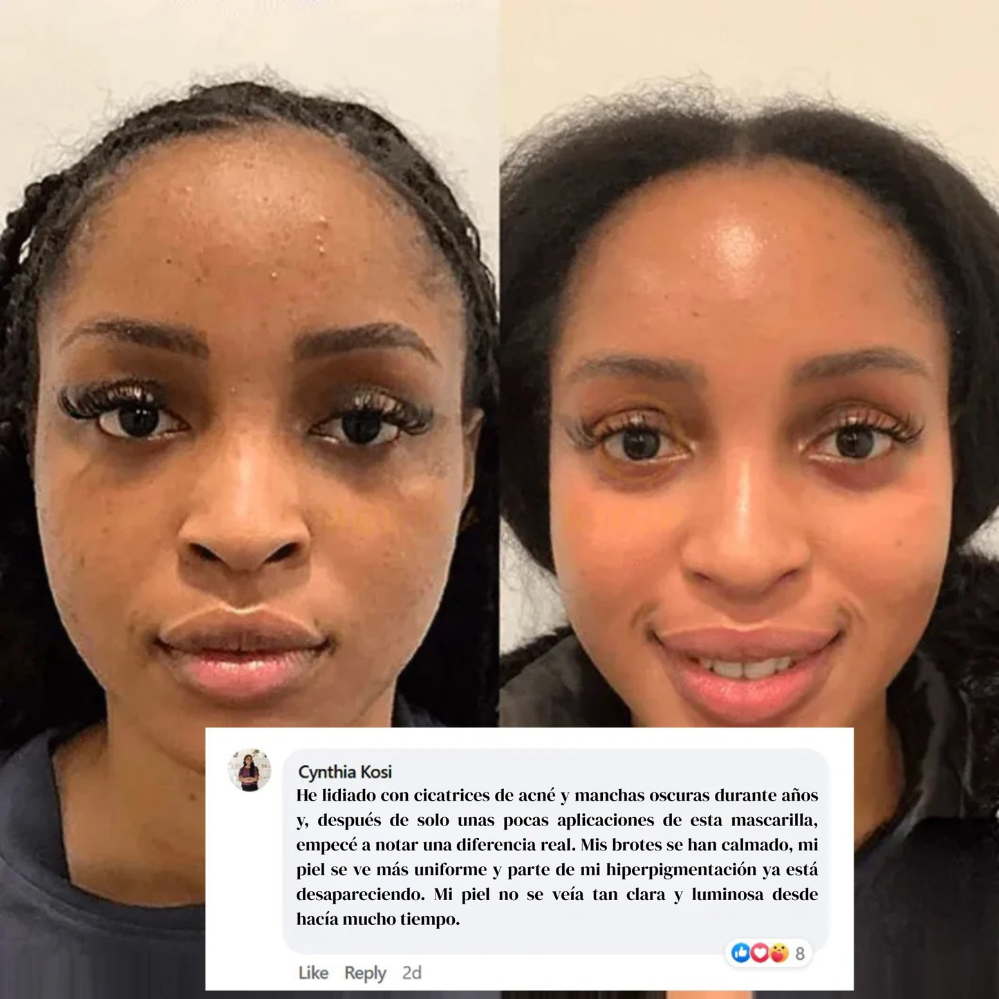 MASCARILLA DE COLAGENO